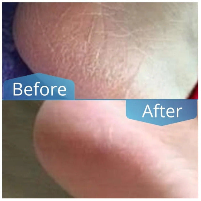 Imperial Feet Foot Balm Green