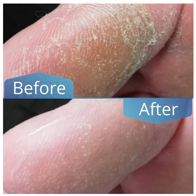 Imperial Feet Foot Balm Soft